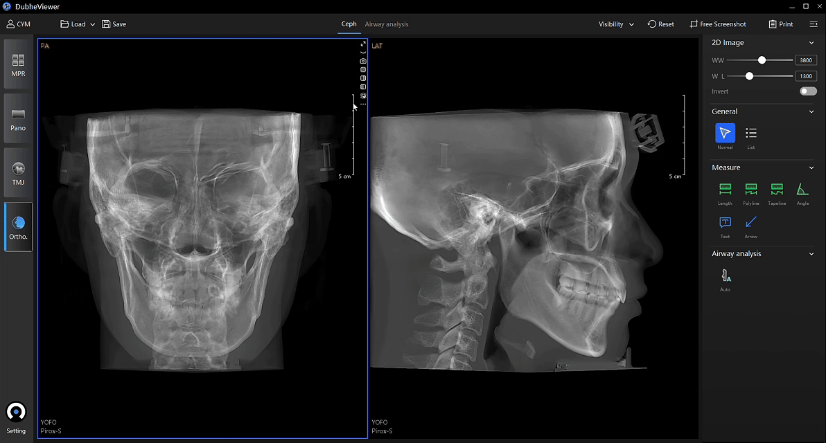 Advanced cephalometric analysis interface